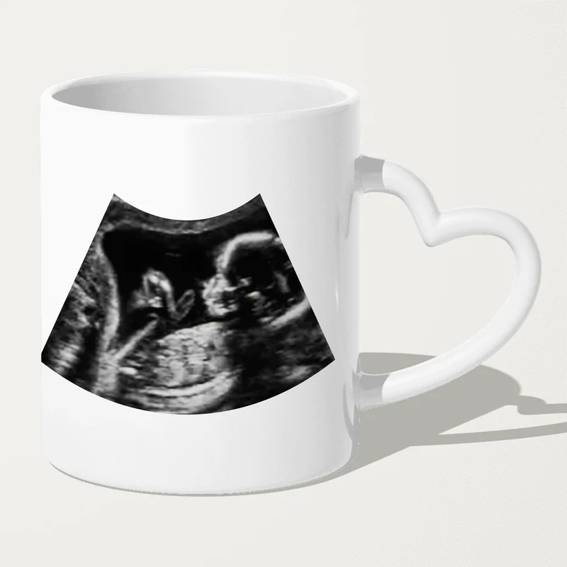 Personalisierte Tasse - Hi Papa, ich freu mich dich zu sehen... mit Ultraschallbild
