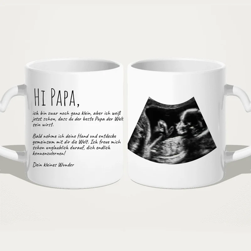Personalisierte Tasse - Hi Papa, ich freu mich dich zu sehen... mit Ultraschallbild